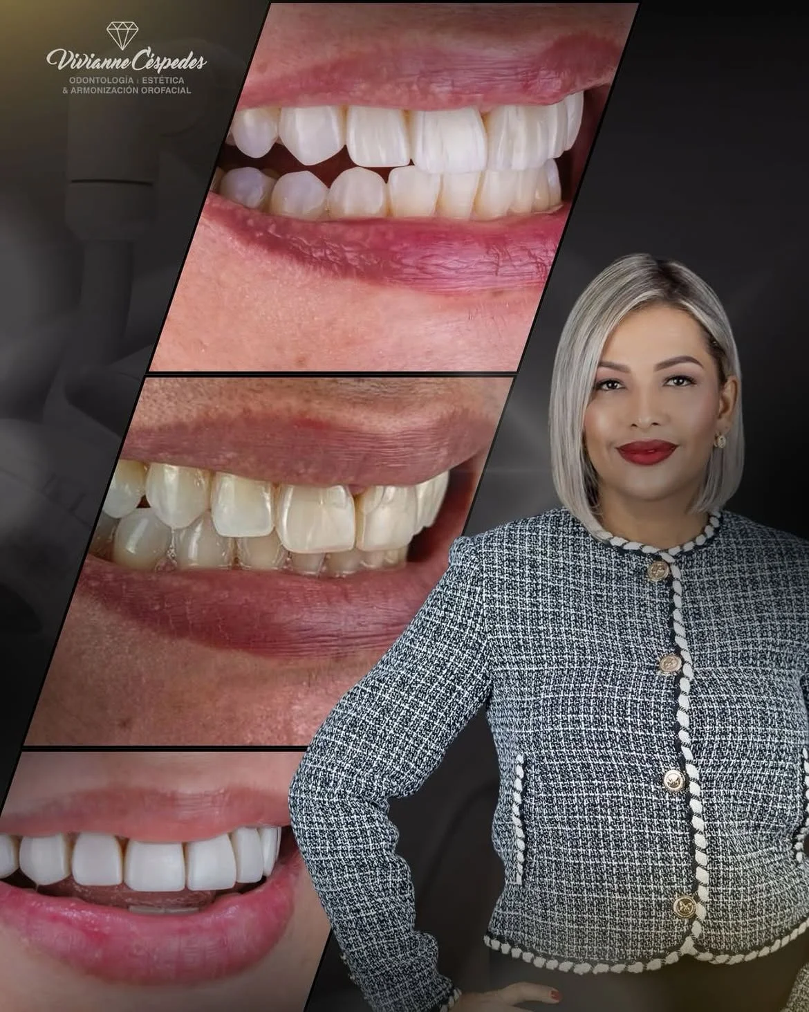 Diseño de Sonrisa