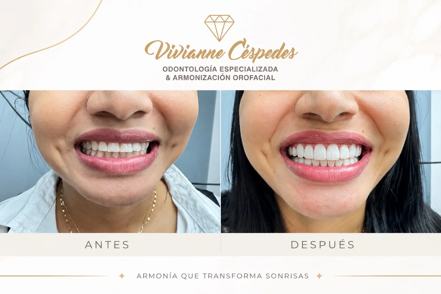 Transformación de Sonrisa