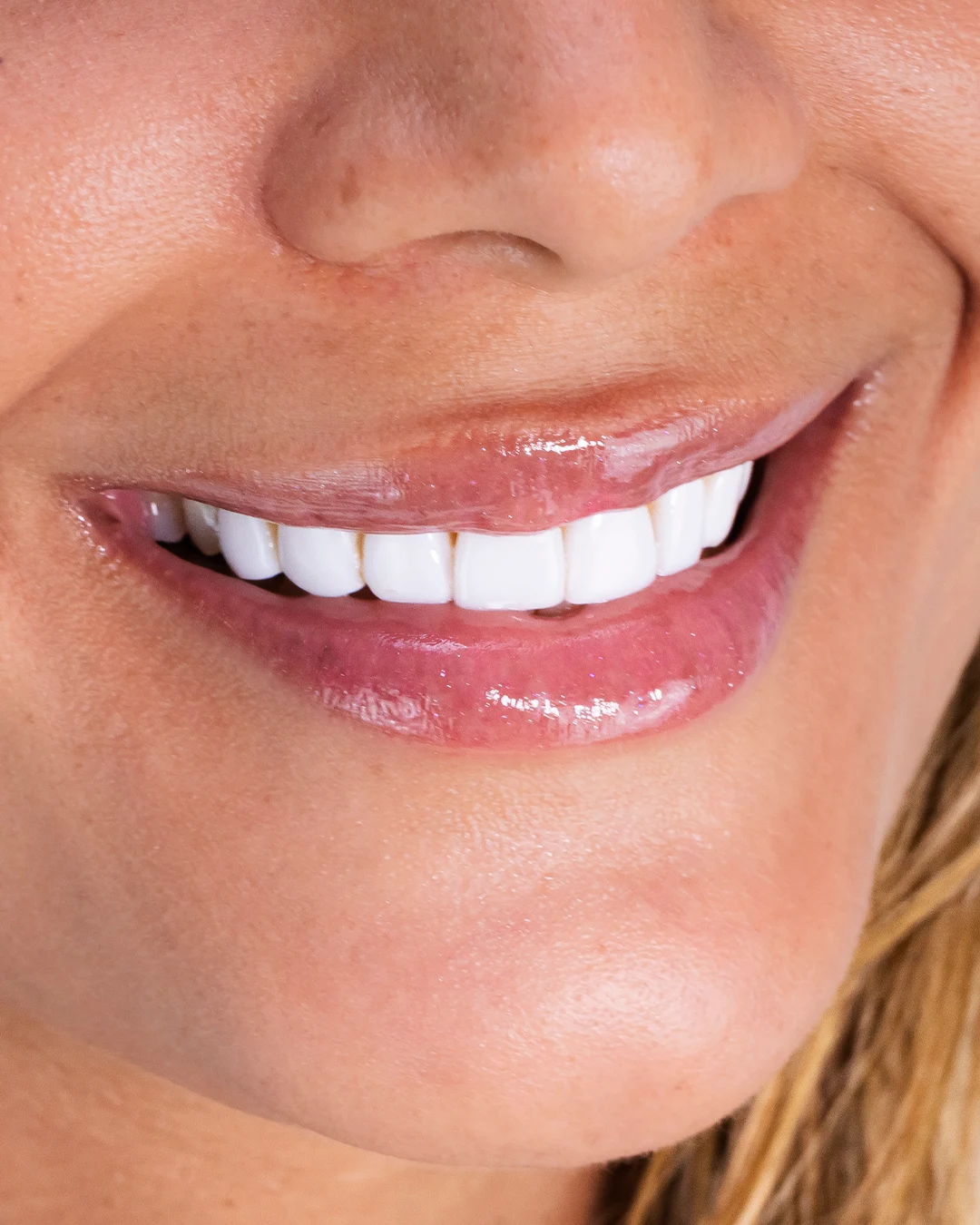 Rehabilitación Oral
